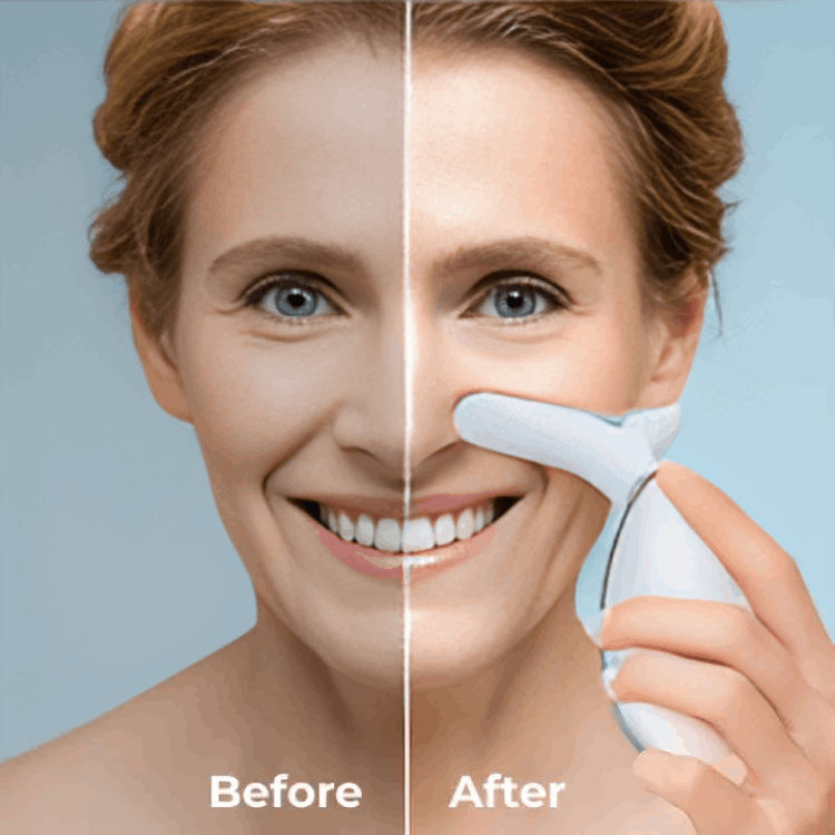 what is Aiven ContourLift Sculptor